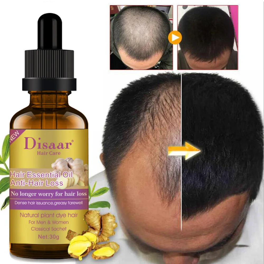 DISAAR Huile Capillaire  Essence de Gingembre