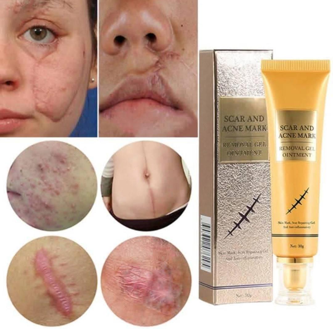 Crème Réparatrice Anti Cicatrice + (BONUS Disaar Vitamin C)